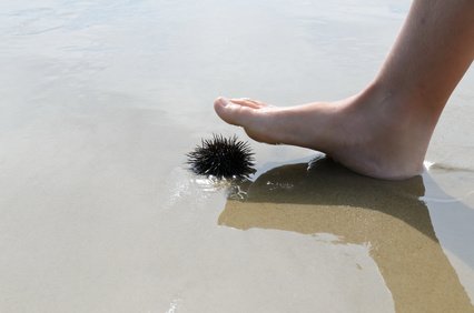 Achtung, Seeigel! © fotofrank - Fotolia.com